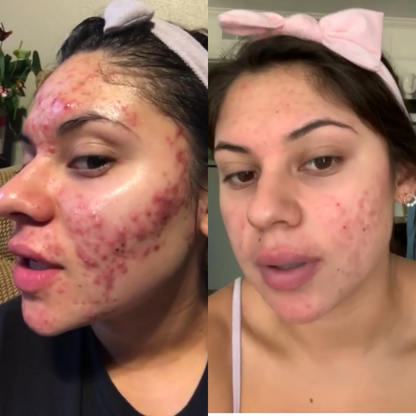 dr. Melaxin  l Ampolla exfoliante de arroz radiante™