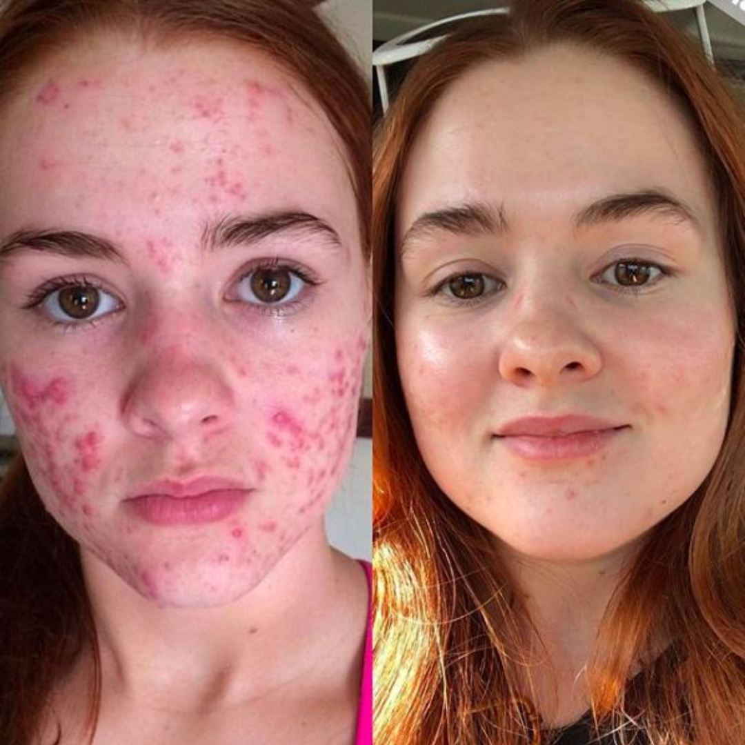 dr. Melaxin  l Ampolla exfoliante de arroz radiante™