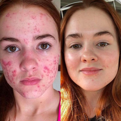 dr. Melaxin  l Ampolla exfoliante de arroz radiante™