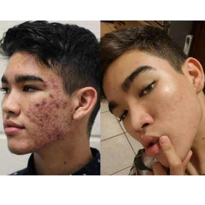 dr. Melaxin  l Ampolla exfoliante de arroz radiante™