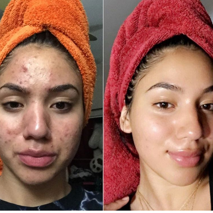 dr. Melaxin  l Ampolla exfoliante de arroz radiante™