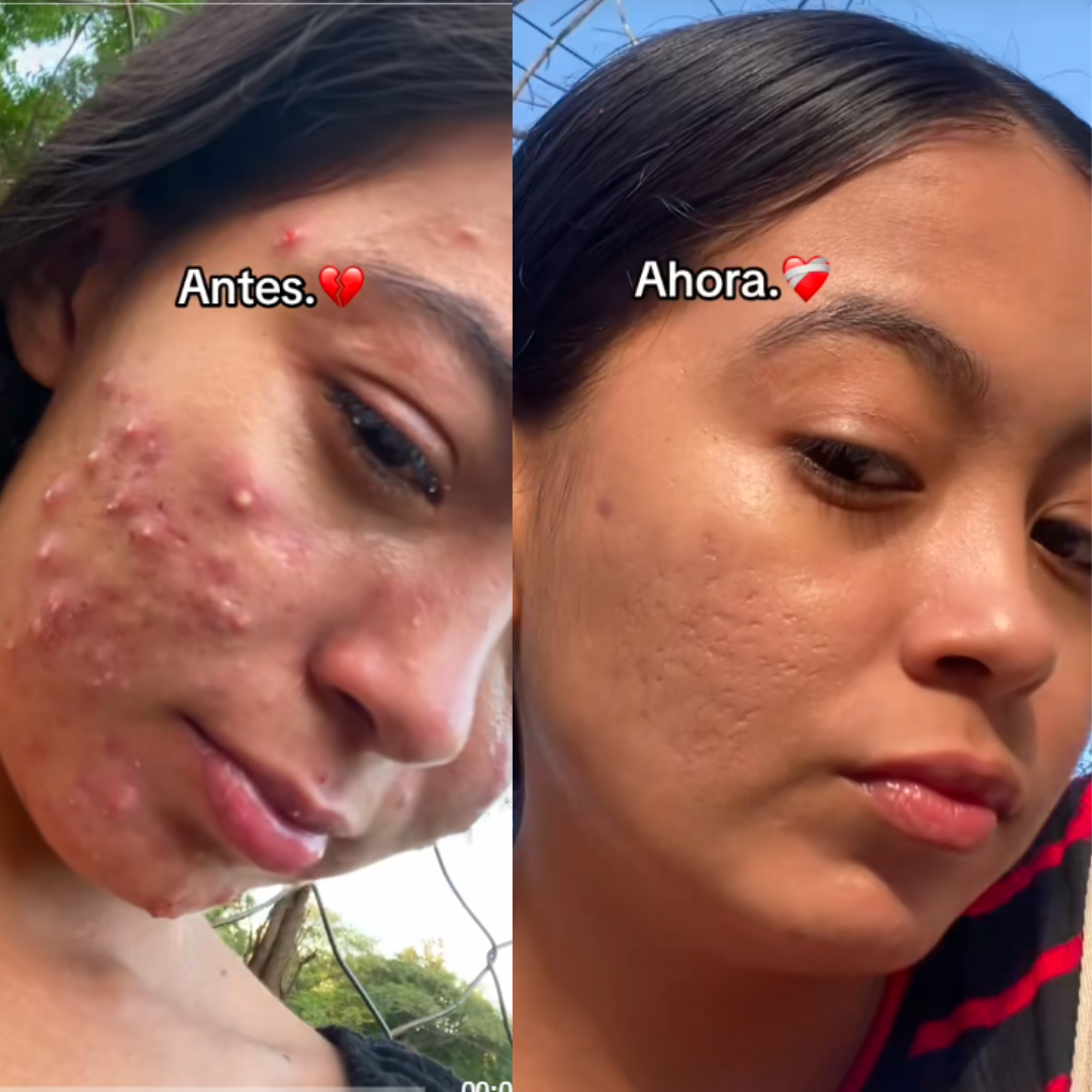 dr. Melaxin  l Ampolla exfoliante de arroz radiante™