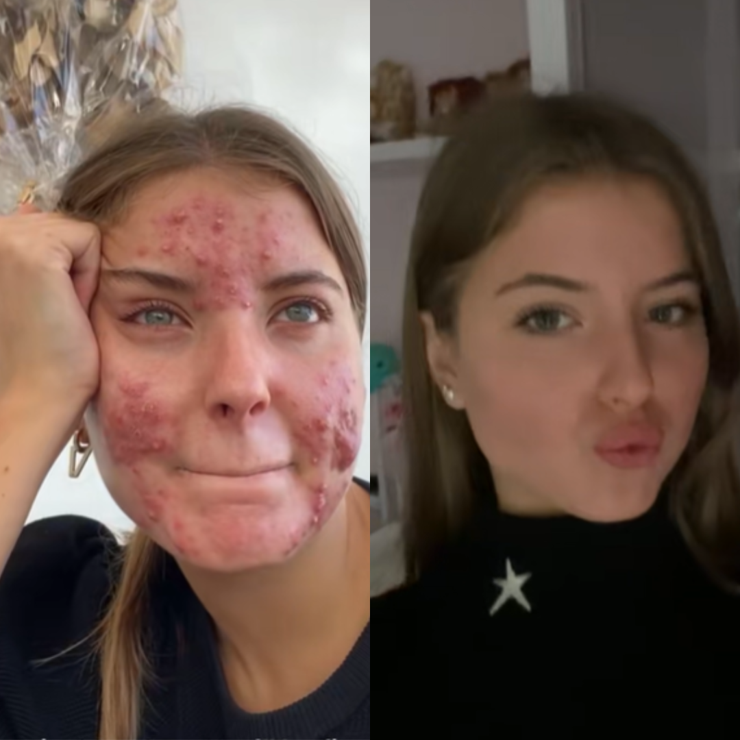 dr. Melaxin  l Ampolla exfoliante de arroz radiante™