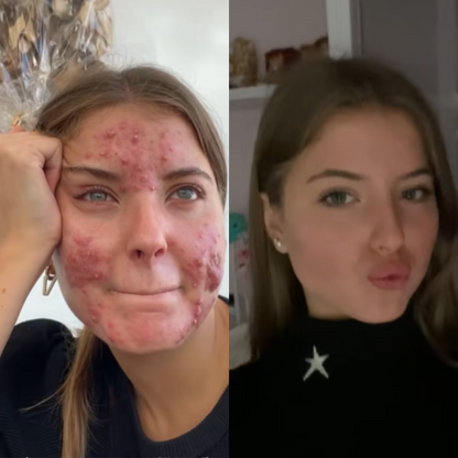 dr. Melaxin  l Ampolla exfoliante de arroz radiante™