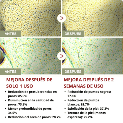 dr. Melaxin  l Ampolla exfoliante de arroz radiante™
